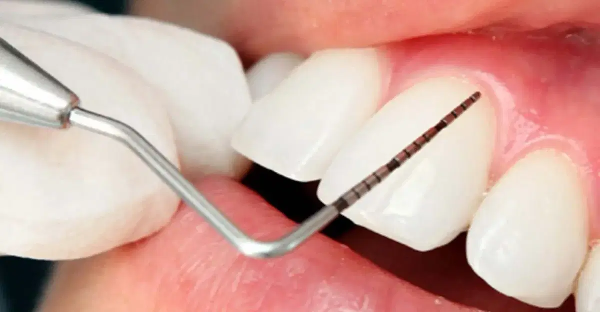 Periodontology in Turkey