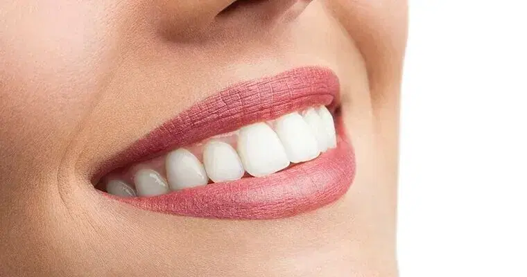 Teeth Whitening in Turkey