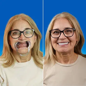 Dental