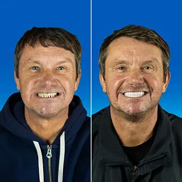 Dental