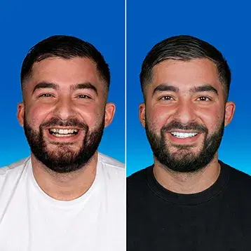 Dental