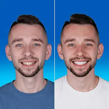 Dental