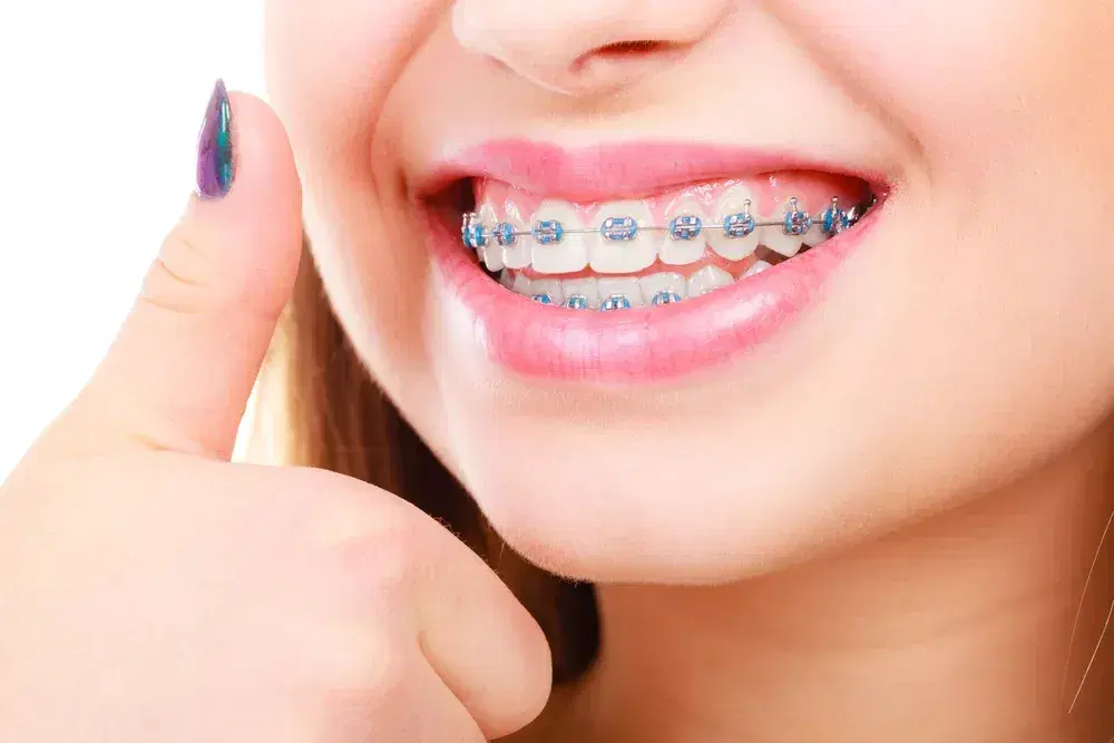 braces care