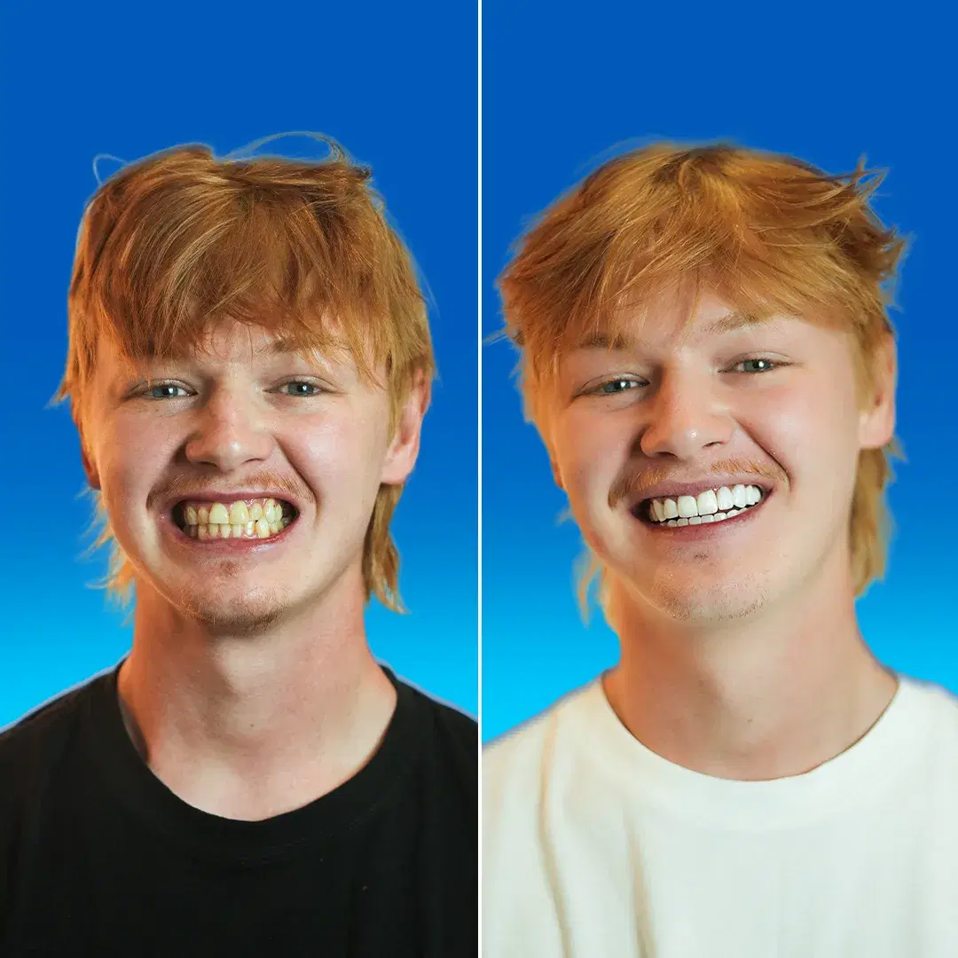 Dental