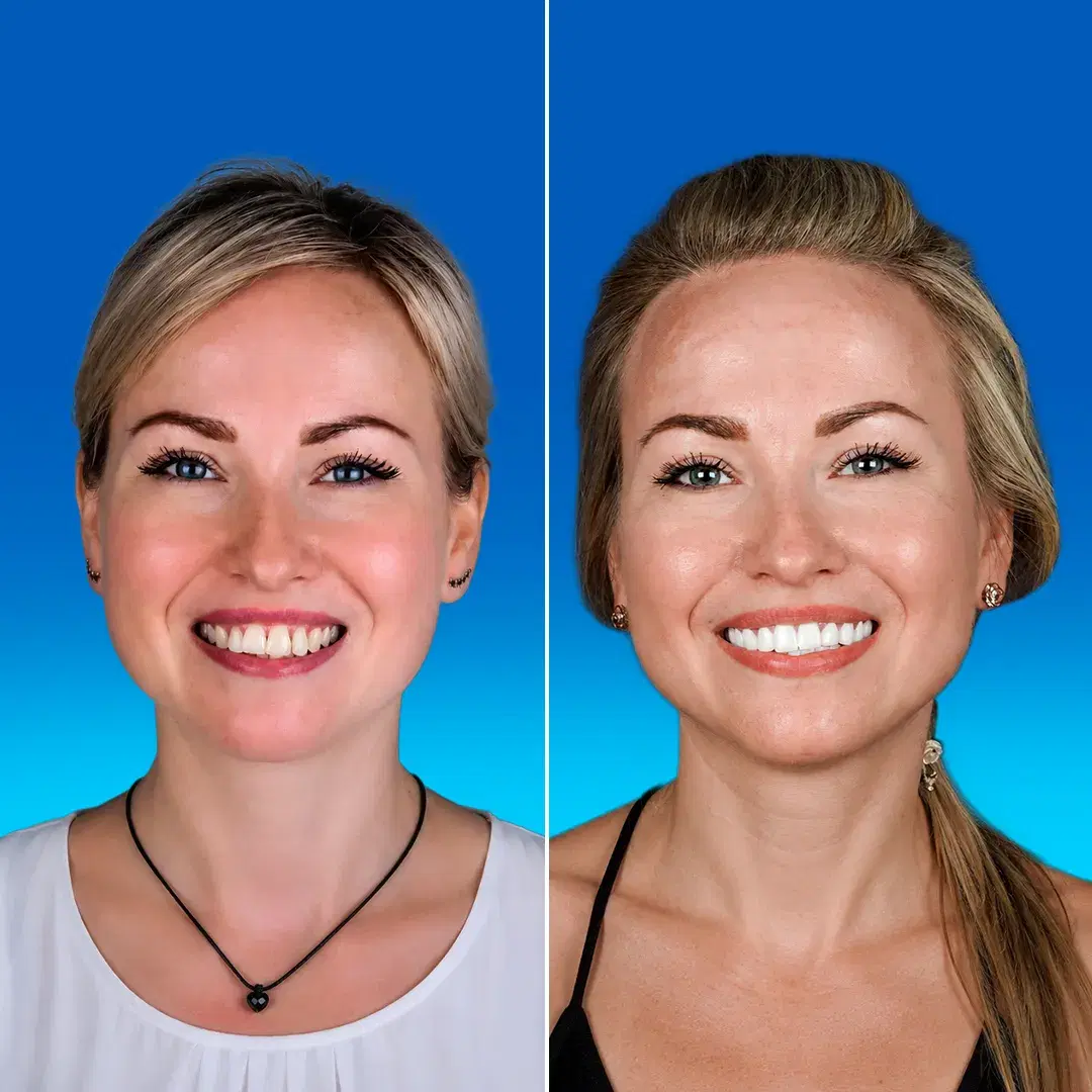 Dental