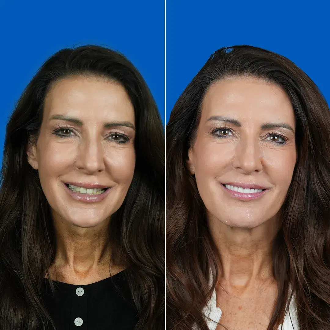Dental