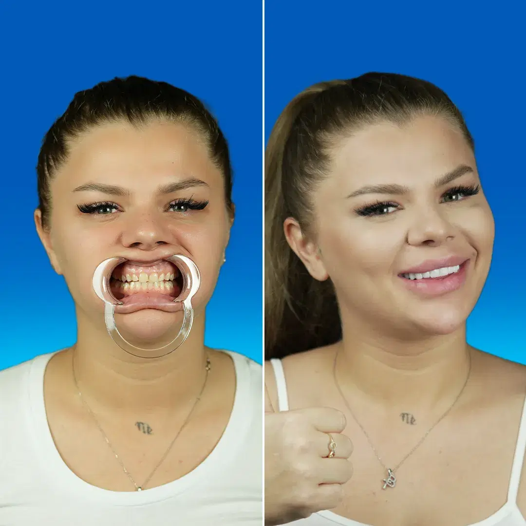 Dental