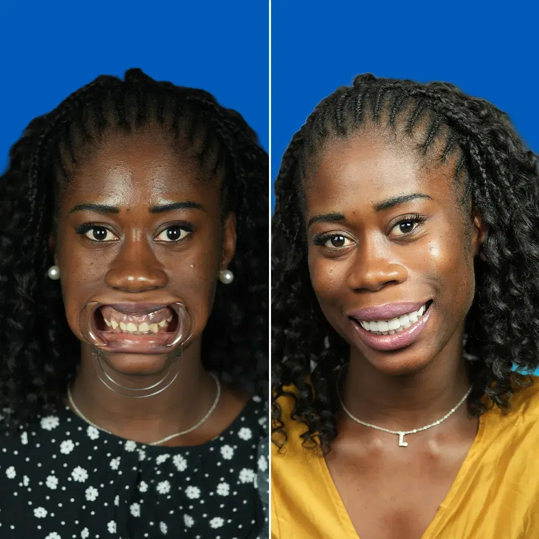 Dental