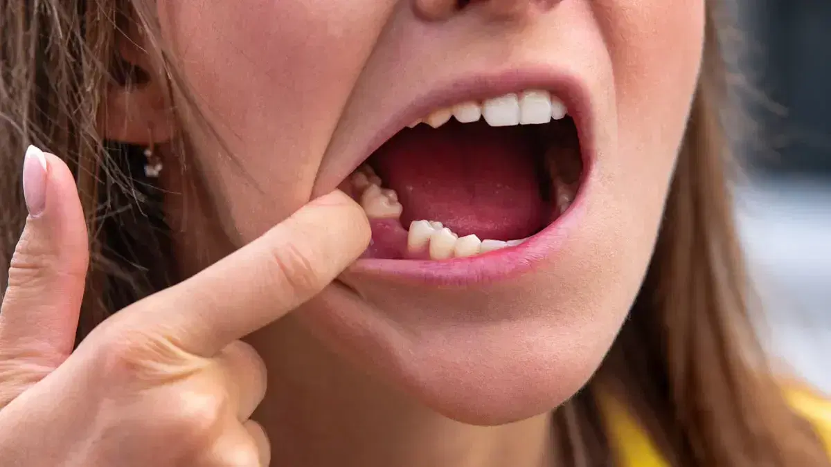 Missing Tooth